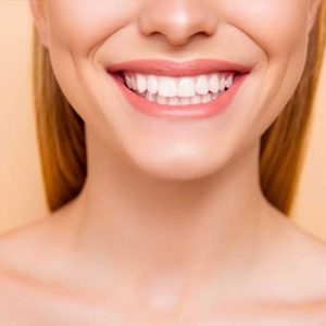sonrisa_blanqueamiento